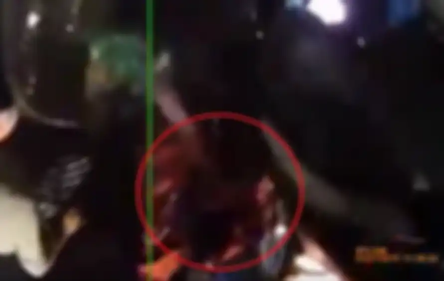 Bagian bawah jas hujan ponco pembonceng ini tersangkut di rantai dan gir motor.