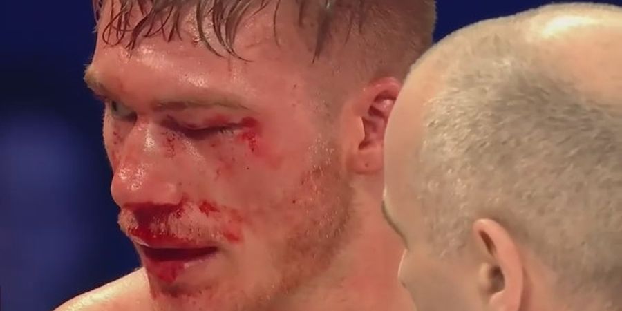 Ngeri! Petinju Nick Blackwell Mengaku Sempat Merasakan Kematian