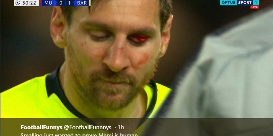 Imbas Dihantam Bek Man United, Hidung Lionel Messi Memar