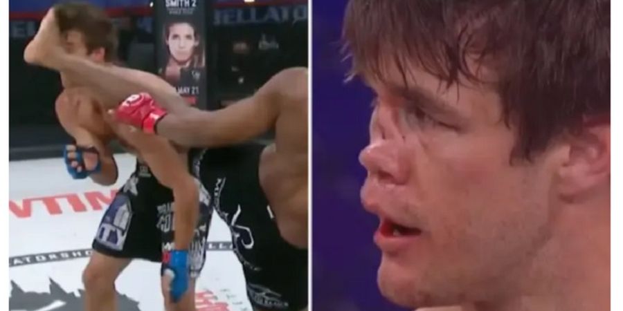 Bikin Ngilu! Tendangan Brutal Petarung MMA Ini Bikin Hidung Lawan 'Tenggelam'