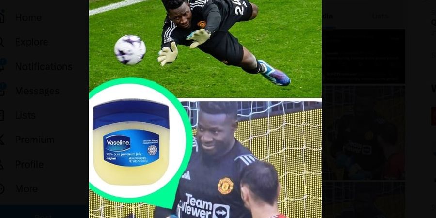 Andre Onana Pakai Salep Pelembap Kulit, Inikah Rahasia Kiper dengan Penyelamatan Terbanyak Liga Inggris?