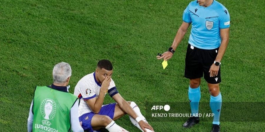 EURO 2024 - Hidung Patah dan Kartu Kuning Konyol Tanpa Gol, Kylian Mbappe Belum Berjodoh dengan Piala Eropa 