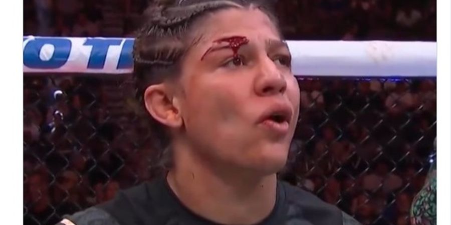 Hasil UFC 303 - Kacau Balau, 1 Pertarungan Disetop karena Luka Robek Sampai Tulang Terlihat