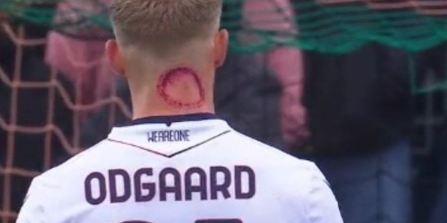 Liga Italia - Lawan Jay Idzes Membuat Klarifikasi Usai Gigitan Zombie Viral di Media Sosial