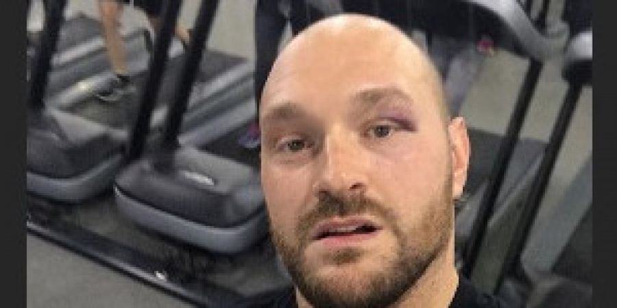 Ditolak Anthony Joshua, Tyson Fury Siap Menantang 2 Petarung Ini