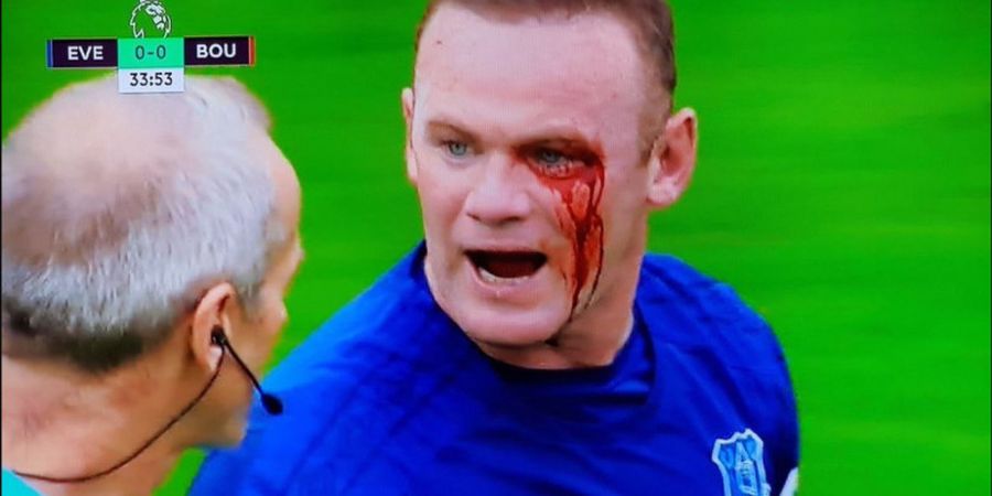 Kocak! Begini Meme yang Dibuat oleh Netizen tentang Tragedi Berdarah Wayne Rooney