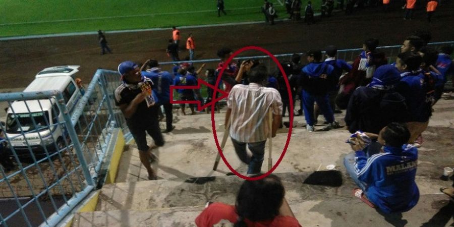 Suporter Ini Tunjukkan Keadaan Tak Jadi Penghalang untuk Dukung Arema FC