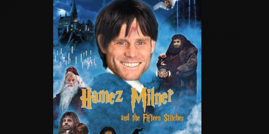 Akibat Luka di Kening, James Milner Disamakan dengan Tokoh Harry Potter