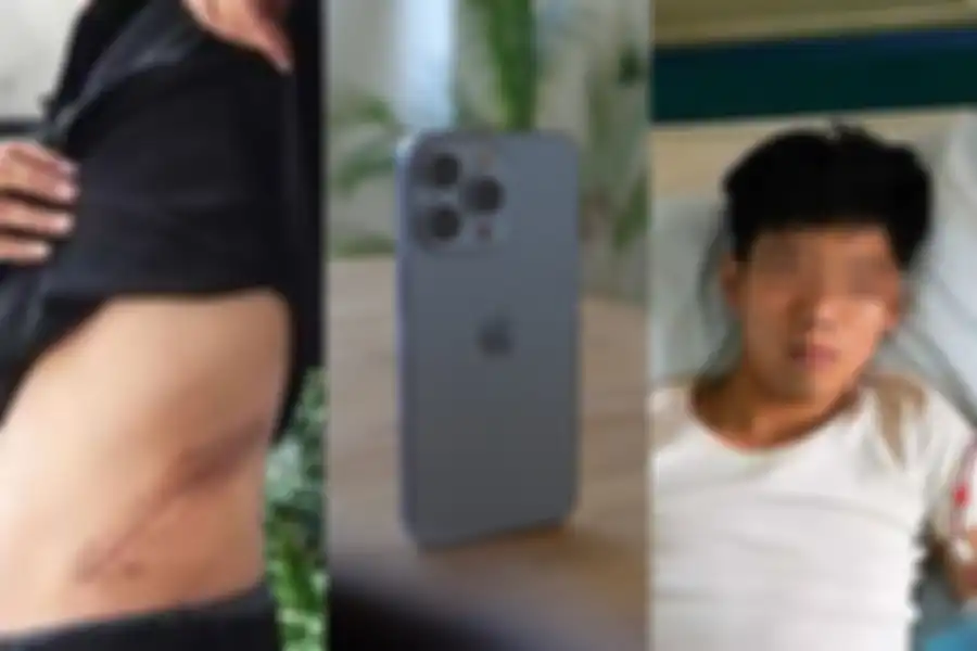 ilustrasi pria yang rela jual ginjal demi membeli iPhone.