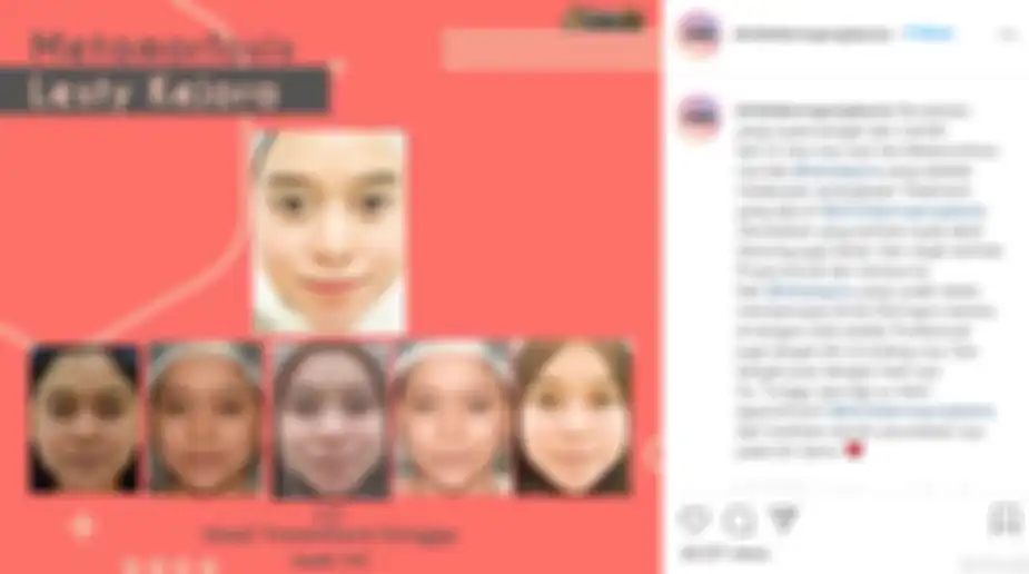 Foto perubahan wajah Lesty Kejora