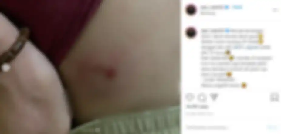 Rizki DA pamer tubuhnya yang terluka