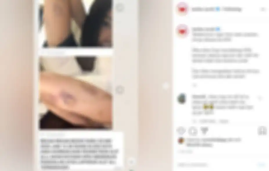 Bukti Aska Ongi digebuki oleh Aliff Alli