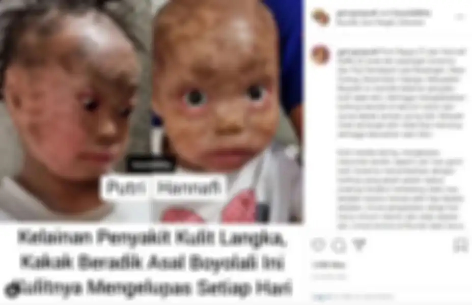 Kelainan penyakit kulit langka