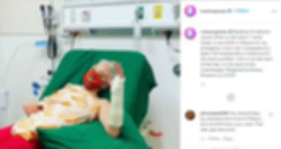 Gegara membaca hasil pemilu AS, Rose McGowan terjatuh dari tangga hingga alami patah tulang.