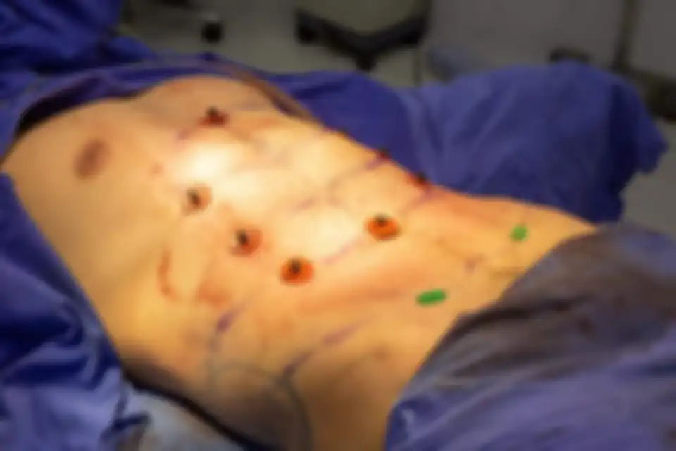 Operasi six pack instan.