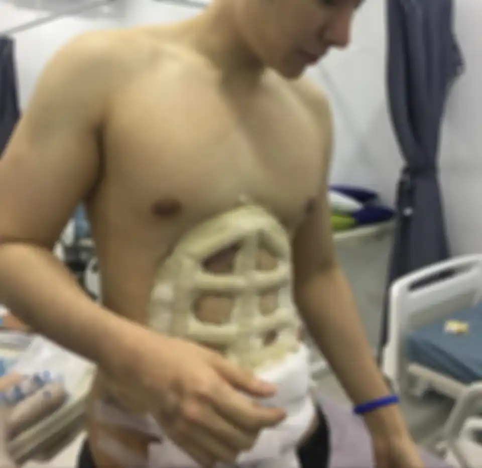 Operasi six pack instan.