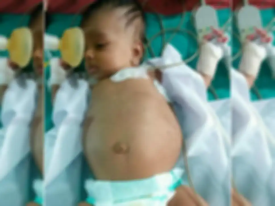 Dokter menduga ada tumor di dalam bayi ini