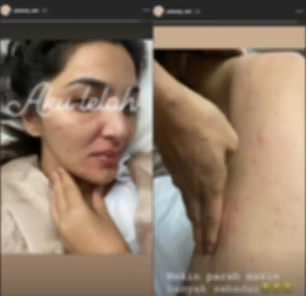 Kondisi terkini Ashanty