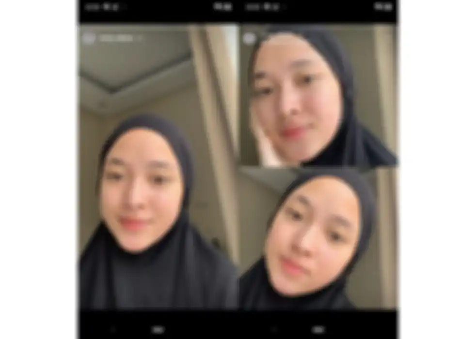 Unggahan Nissa Sabyan yang memperlihatkan wajahnya yang berjerawat 
