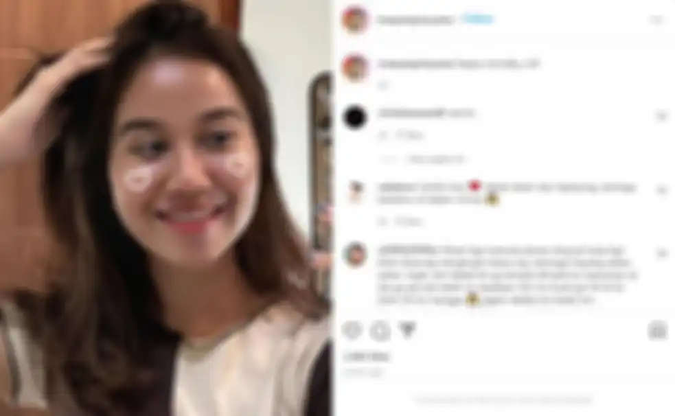 Mayang unggah foto baru dirinya pasca menjalani perawatan puluhan juta dan pasang behel.