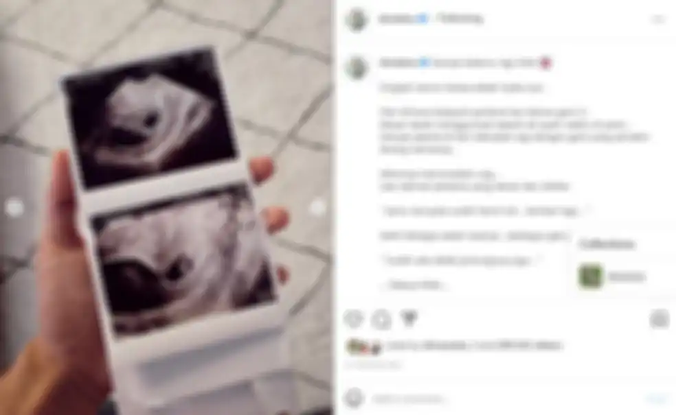 Postingan Dinda Hauw ceritakan momen kehamilannya hingga alami keguguran.
