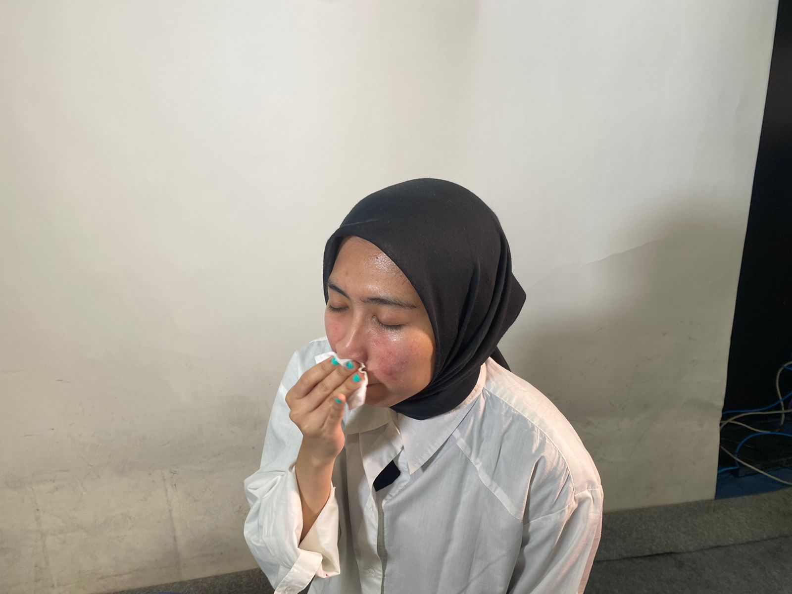 Jangan Keliru! Ini Perbedaan Jerawat Tanda Kehamilan dan Haid – Semua Bтум Fashionista Batu Dua Dan Misafir Misal