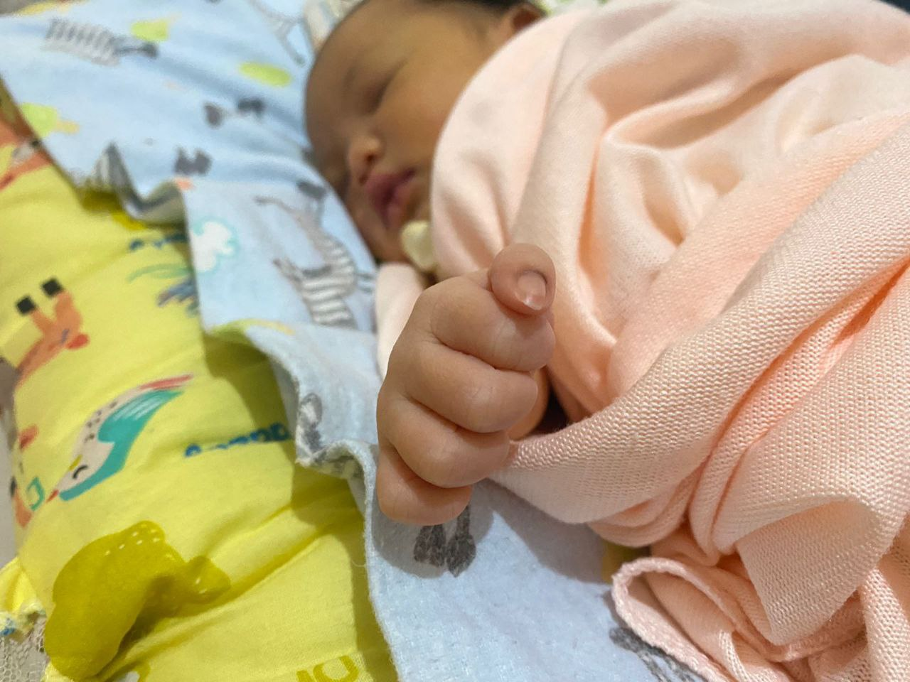 Obat Bayi Penyakit Kuning Saat Baru Lahir, Yuk Kenali Penyebab dan Cara