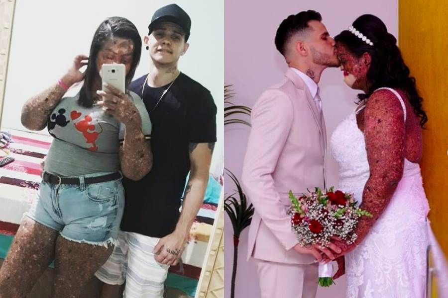 Tetap Cinta Meski Tampilan Fisik Pasangannya Tidak Sempurna ...