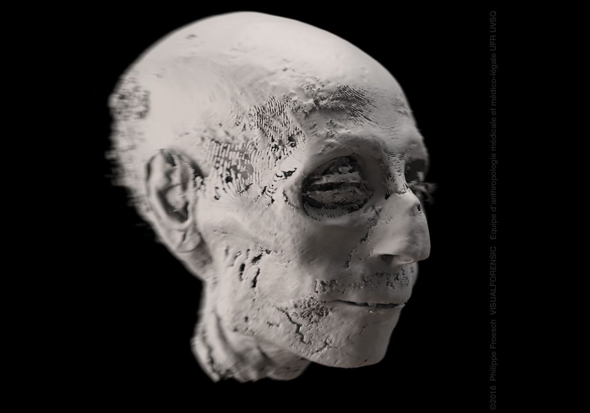 Tish karies bilan ogzaki jinsiy aloqa Retro kovboy porno