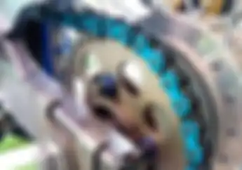 Ini Video Bayi Umur 6 Bulan Yang Kakinya Putus Karena Nyangkut di Rantai Motor