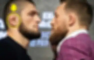 Kenapa Telinga Khabib Nurmagomedov Bentuknya Berbeda Dari Manusia Lain?