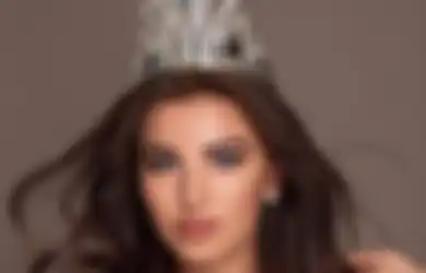 5 Fakta Menarik Chanique Rabe, Miss Supranational 2021 Asal Namibia!