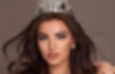 5 Fakta Menarik Chanique Rabe, Miss Supranational 2021 Asal Namibia!