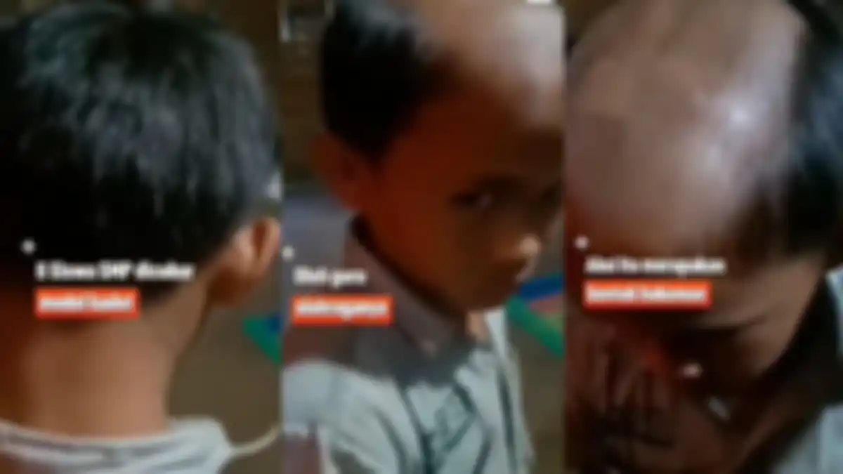 Ortu murka putranya dibotaki seenaknya oleh guru.