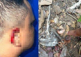 Imbas Masalah Hutang Piutang, Pria Ini Dipotong Daun Telinganya hingga Putus dan Ditinggalkan di Kawasan Gunung, Begini Akhirnya
