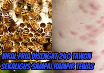 Dapat Sengatan Sebanyak 240 dari Tawon yang Sedang Tantrum, Pria Ini Hampir Tewas Jika Terlambat 5 Menit Dibawa ke Sini