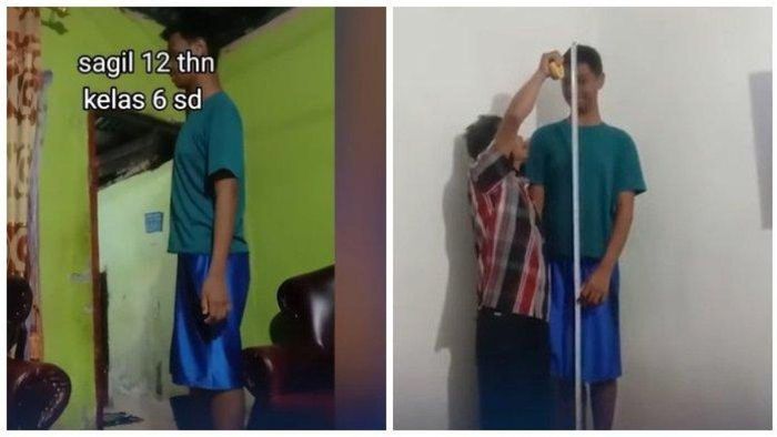 Sagil, sosok siswa Sekolah Dasar (SD) di Kerinci, Provinsi Jambi, yang memiliki tinggi 2 meter