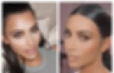 Kim Kardashian Derita Penyakit Kulit Psoriasis Selama Bertahun-tahun, Ini 10 Fakta Mengejutkan Psoriasis