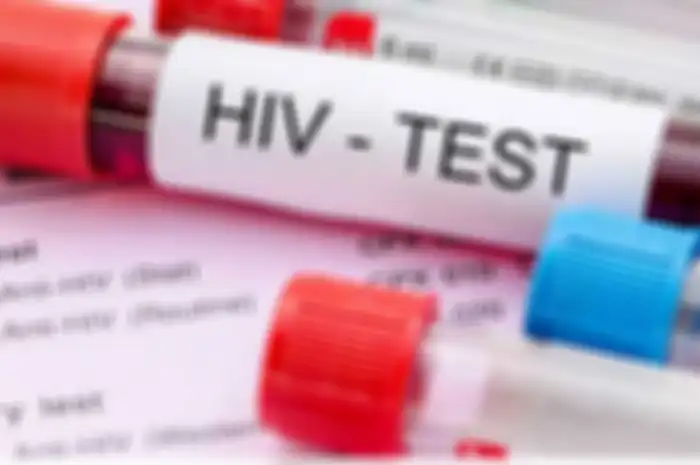 Kondisi kulit dapat menjadi salah satu tanda awal HIV dan dapat muncul selama tahap primer. Kondisi kulit yang bagaiman?