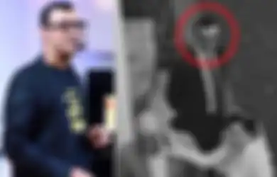 Sosok Jacky Mussry, Doktor Tampan Adik Ipar Maia Estianty, Duduki Kursi Wakil Presiden Direktur di Perusahaan Ternama, Ini Potretnya 
