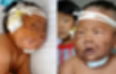 Kasian, Bayi 8 Bulan Ditusuk 90 Kali dengan Gunting Gara-gara Gigit Puting Ibunya Saat Menyusu