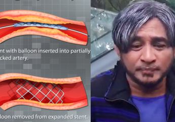 Hampir Renggut Nyawa Jeremy Teti hingga Terpaksa Konsumsi Obat Seumur Hidup, Ternyata Begini Kondisi Tubuh Setelah Pemasangan Ring Jantung, Jangan Dianggap Enteng!