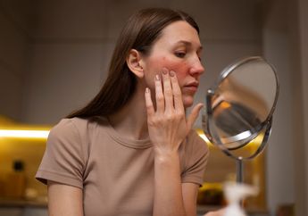 Bekas Jerawat Susah Hilang? Tak Perlu Risau, 4 Tips Ini Terbukti Ampuh Bisa Bantu Memudarkan dan Menghilangkan!