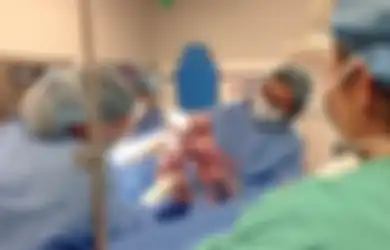 Bayi Kembar Ini Kejutkan Satu Ruangan dan Bikin Dokter Menjerit Usai Lahir, Sang Ibu yang Penasaran pun Kaget Melihat Bayinya seperti Ini!