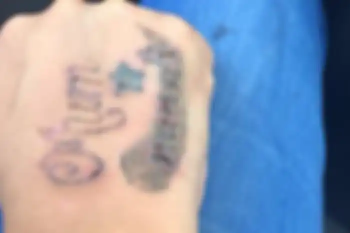 Menghapus tato.