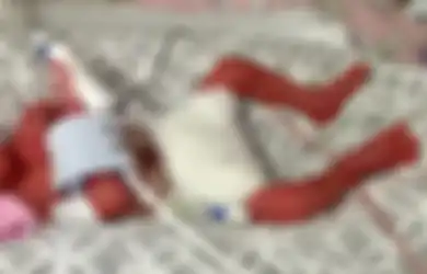 Dulu Lahir Dengan Berat 600 Gram dan Tak Punya Harapan Hidup, Kini Begini Keadaan Balita Ini Setelah 3 Tahun