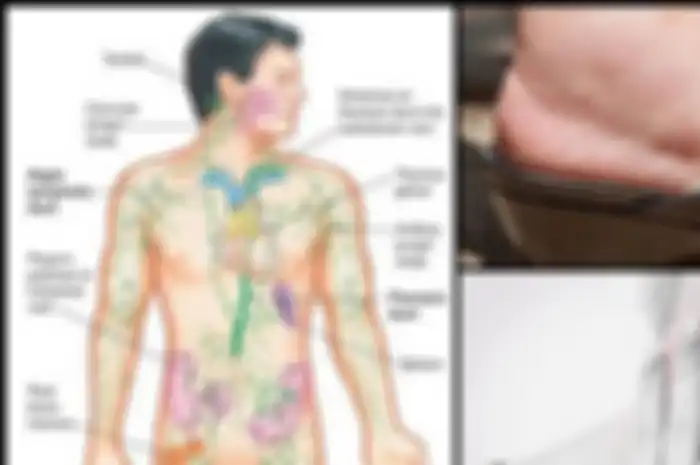 Untuk menurunkan berat badan dan meningkatkan perasaan kesejahteraan adalah dengan membuat sistem getah bening Anda mengalir dengan lancar.