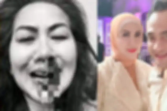 Wajah Venna Melinda Penuh Darah diduga akibat KDRT dari Ferry Irawan