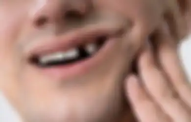 Nggak Perlu Takut Mahal ke Dokter Gigi, Dental Smile Beri Harga Transparan