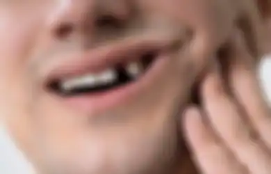 Nggak Perlu Takut Mahal ke Dokter Gigi, Dental Smile Beri Harga Transparan